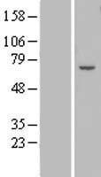 ZNF545 (ZFP82) Human Over-expression Lysate