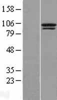 TTC14 Human Over-expression Lysate