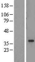ADA2a (TADA2A) Human Over-expression Lysate