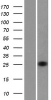 RHOV Human Over-expression Lysate