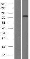 DQX1 Human Over-expression Lysate