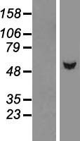 TBL1Y Human Over-expression Lysate