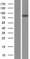 SLC26A6 Human Over-expression Lysate