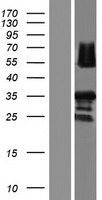 RAD52 Human Over-expression Lysate