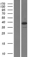 TRBP (TARBP2) Human Over-expression Lysate