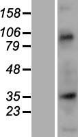 Nup53 (NUP35) Human Over-expression Lysate