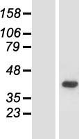ACMSD Human Over-expression Lysate