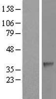 SDSL Human Over-expression Lysate