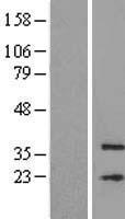 MFSD3 Human Over-expression Lysate