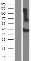 ADAT3 Human Over-expression Lysate