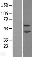 PHF21B Human Over-expression Lysate