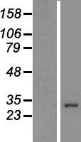 SGF29 Human Over-expression Lysate