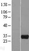 HOGA1 Human Over-expression Lysate