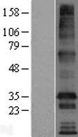 TMEM169 Human Over-expression Lysate