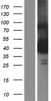 TTC5 Human Over-expression Lysate