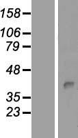 Protein kinase like protein SgK493 (PKDCC) Human Over-expression Lysate