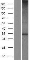 C19orf52 (TIMM29) Human Over-expression Lysate