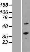 ROR alpha (RORA) Human Over-expression Lysate