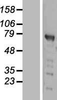 PWWP domain containing protein 2B (PWWP2B) Human Over-expression Lysate