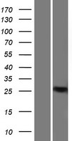 CTIP1 (BCL11A) Human Over-expression Lysate