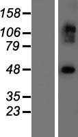 EXOC3L2 Human Over-expression Lysate