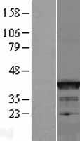 Bcl G (BCL2L14) Human Over-expression Lysate