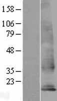TM4SF18 Human Over-expression Lysate