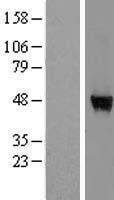 WDR85 (DPH7) Human Over-expression Lysate