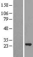 MRRF Human Over-expression Lysate