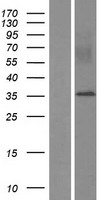 MYEOV Human Over-expression Lysate