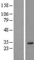 Prune homolog 2 (PRUNE2) Human Over-expression Lysate