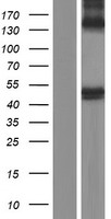 BACE1 Human Over-expression Lysate