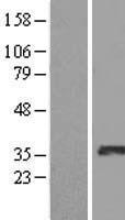 RDHE2 (SDR16C5) Human Over-expression Lysate