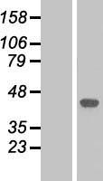 p38 (MAPK14) Human Over-expression Lysate