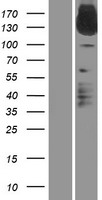 IL31RA Human Over-expression Lysate