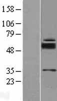 SLC39A11 Human Over-expression Lysate