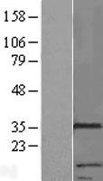 RNF133 Human Over-expression Lysate