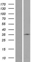STARD6 Human Over-expression Lysate