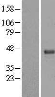 TRUB1 Human Over-expression Lysate