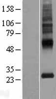 MLC1 Human Over-expression Lysate