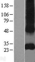 CD151 Human Over-expression Lysate