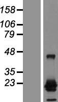NY-ESO-1 (CTAG1A) Human Over-expression Lysate