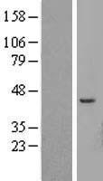 ATP6V1C2 Human Over-expression Lysate