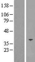 SFXN5 Human Over-expression Lysate