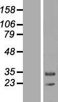 MAPK1IP1L Human Over-expression Lysate