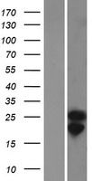 COQ10A Human Over-expression Lysate