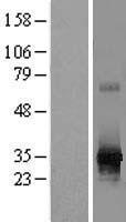 RPIA Human Over-expression Lysate