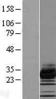 TMEM182 Human Over-expression Lysate