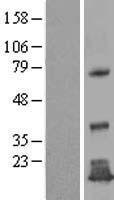 TMEM125 Human Over-expression Lysate