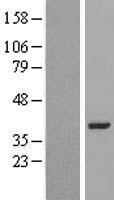 LRRC39 Human Over-expression Lysate